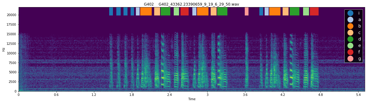 _images/syntax_analysis_demo_62_0.png